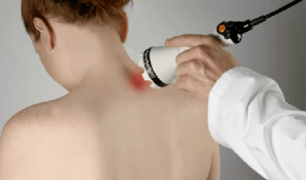 Treatment of cervical osteochondrosis through physiotherapy