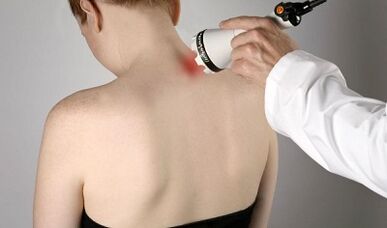 Treatment of pain in physiotherapy procedures of the neck
