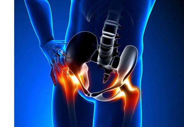 Coxrtrosis pain