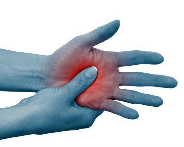 Severe pain in the joints of the fingers, decreasing with physical exertion, is a typical sign of rheumatoid arthritis. 